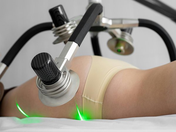 Liposuccion à paris : redéfinissez votre silhouette dès aujourd'hui !